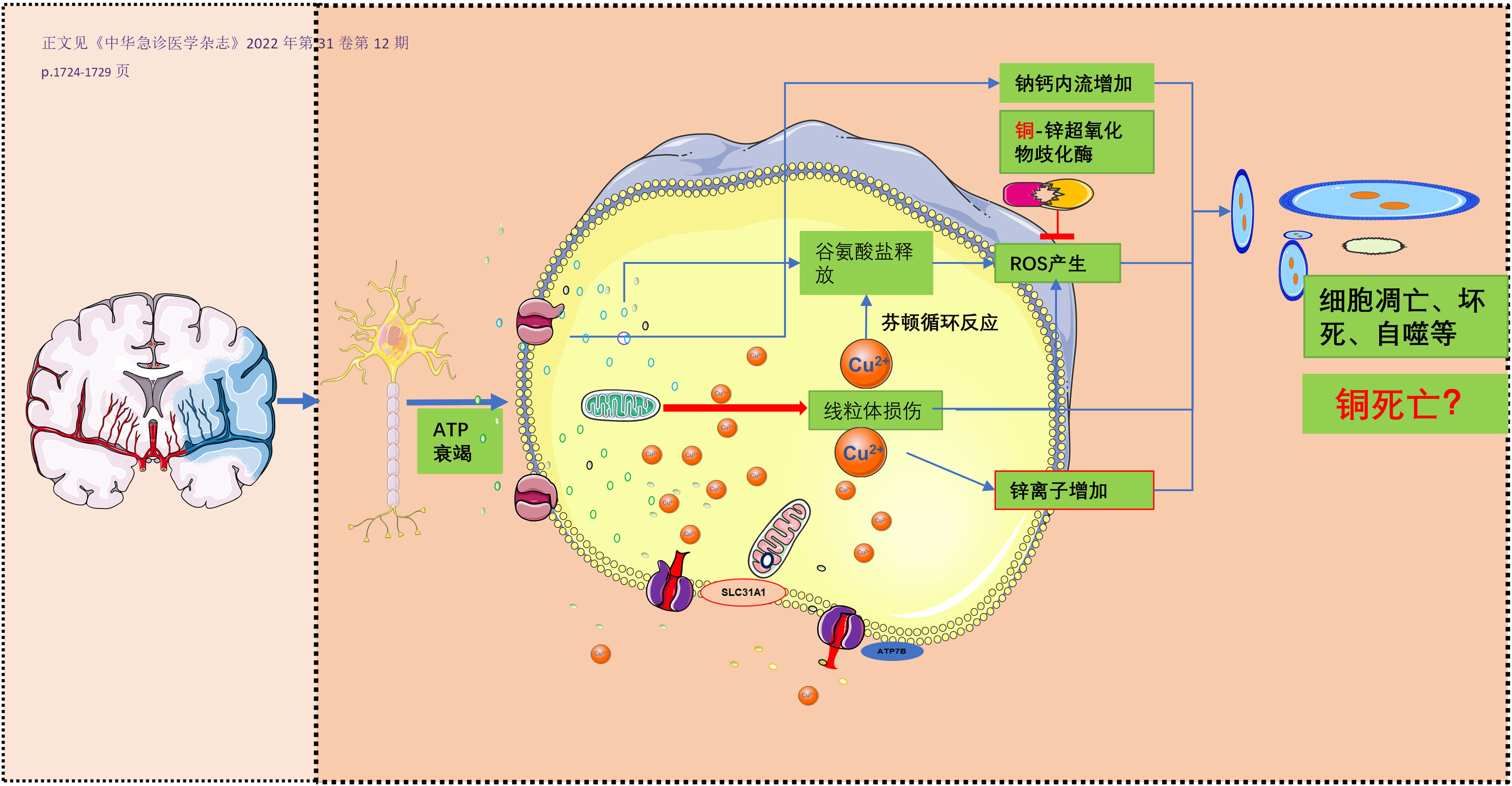 图3. 脑卒中铜死亡可能的机制示意图.jpg