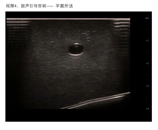 视频4 平面外法