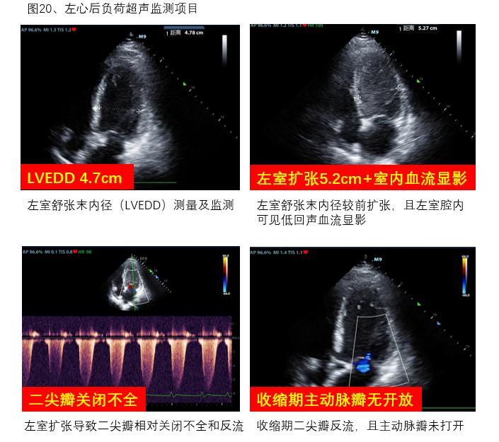 图20 左心室后负荷超声监测项目