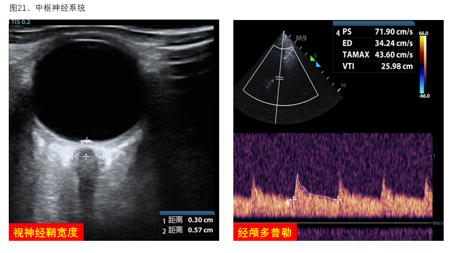 图21 中枢神经系统