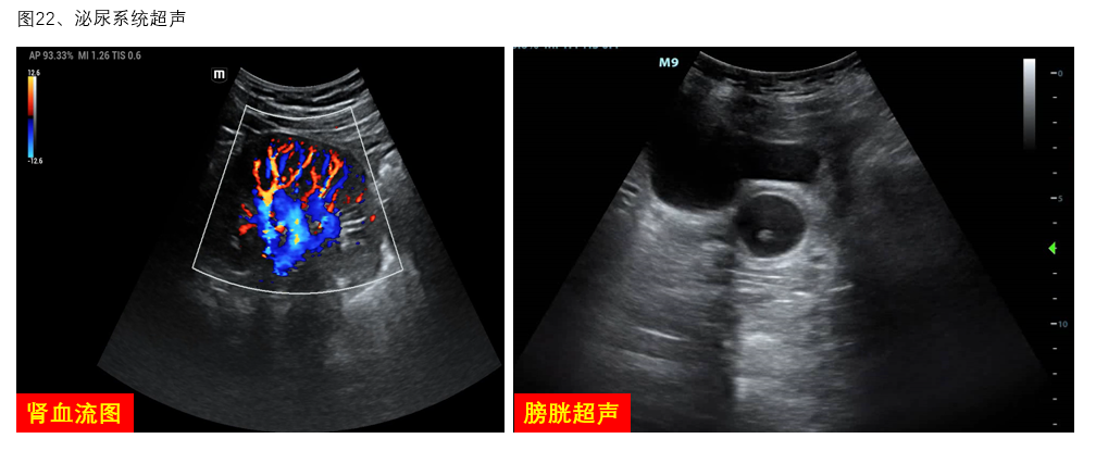 图22 泌尿系统超声