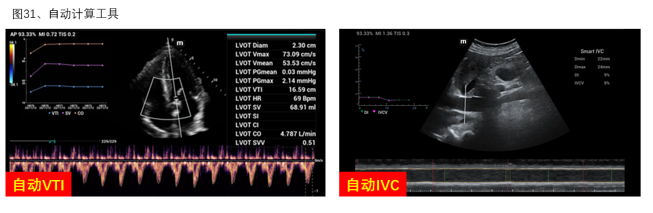 图31 自动计算工具